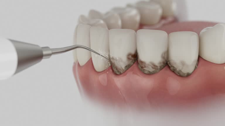 Reliable Dental contractor in Osseo, WI by Smile Center Dentistry